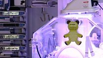 What does it take to care for the sickest premature babies?