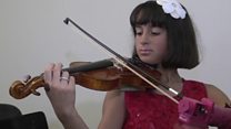 Ten-year-old violinist gets prosthetic arm