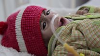 خطر قحطی همزمان با جنگ یمن