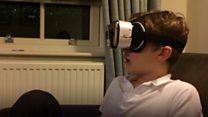 Goggles give Charlie new sight
