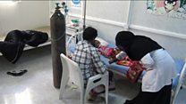"بزرگترین بحران قحطی جهان" در یمن