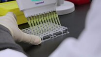 تطوير لقاحا لسرطان الرئة يحقن به الأشخاص في مراحلهم المتقدمة من المرض.