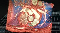 The new 3D image tool for surgeons