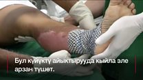 Дартка даба балык