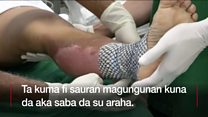 Yadda fatar Karfasa ke maganin kuna