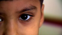 The Syrian refugees battling cancer