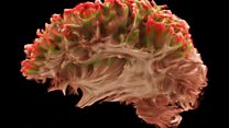Le scanner le plus performant au monde