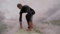 What it's like to lose your leg to a shark