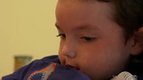 The US boy who outlived medical expectations