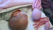 Crocheted octopuses help premature babies