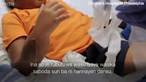 An yi dashen hannaye na farko a duniya