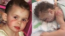 'Five dogs attacked my three-year-old niece'
