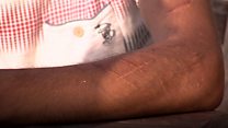 Scarred by IS, 'captive' in Greece