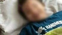 دختر پنج ساله ساوهای قربانی تازه کودک آزاری در ایران
