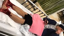 'I had blood all over my ankles'