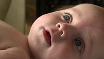 A mother's plea to help fund life saving surgery for her baby son