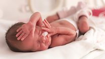Should parents pay to bank baby's cord blood?
