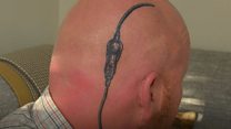 Dad's brain surgery tattoo for daughter