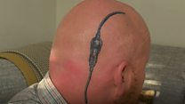 Dad's brain surgery tattoo for daughter