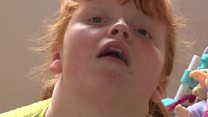 Girl one of 35 in world with rare illness