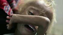 Kisah haru Saleem, bocah Yemen yang menggemparkan dunia