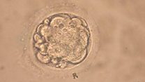 Precise 'chemical surgery' performed