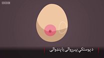 د تي سرطان پر ۱۲ نښو غور وکړئ
