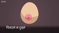 स्तन क्यान्सरको संकेत गर्ने १२ लक्षण