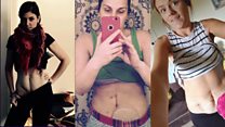 The selfie campaign urging you to 'get your belly out'