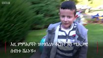 80% ሰብነቱ ብሓድሽ ቆርበት ዝተሸፈነ ህፃን