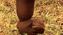 ኣብ ሻኪሶ ዘለኻ ስቓይ