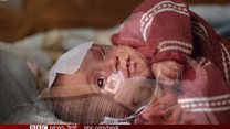 सीरिया: लड़ाई में फंसे बीमार बच्चे