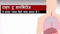 टाइप टू डायबिटीज़- ट्रायल से जगी उम्मीदें