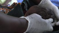 Mortalité néonatale toujours importante en Afrique sub-saharienne