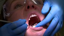 Ces petites habitudes néfastes pour les dents