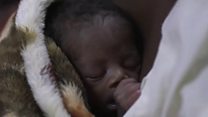 ማላዊ እንዴት የህጻናት ሞትን ቀነሰች?