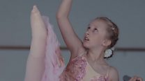 Helping child amputees play