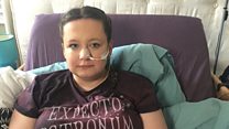 Why I wanted to have my leg amputated