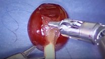 Hospital unveils robotic surgeon