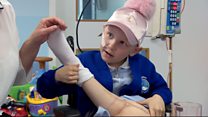 Girl, 7, has leg reattached backwards