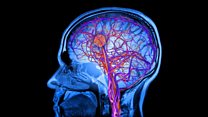 ما معنى عبارةtrain your brain ؟