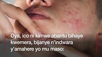 Zoba ari imfungurwa zirimwo amavuta menshi zitera uru herehere mu maso?