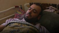 يوم عصيب في مستشفى الشفاء بغزة