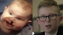 Sheffield student bullied for the way he looked