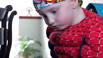 Spider-Man mask makes cancer patient braver