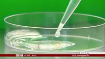 د سینې سرطان درملنه کې پرمختګ