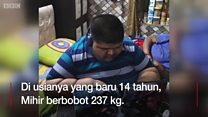 Perjuangan bocah berbobot 237 kg turunkan berat badan