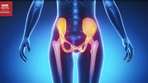Adenomyosis, rasa sakit yang lebih hebat dari melahirkan