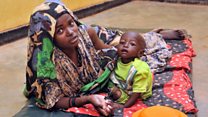 Biraturaba kuko diyabete yiyongereye incuro 4 mw'isi, mu myaka 40 iheze