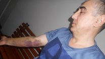 "Бизнесини тортиб олиш учун ўлдиришга ҳам тайёрлар"
